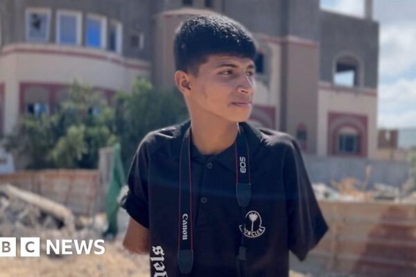 Gaza’s amputees supplied easy-to-fit prosthetics utilizing UK expertise