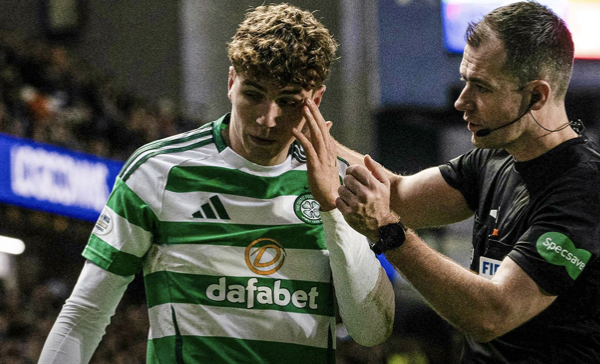 Rangers outdated agency win over Celtic once more mired by violence